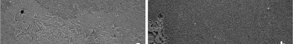 Fig 4. Scanning electron micrographs of bracket base after debonding (original magnification ⅹ 50).