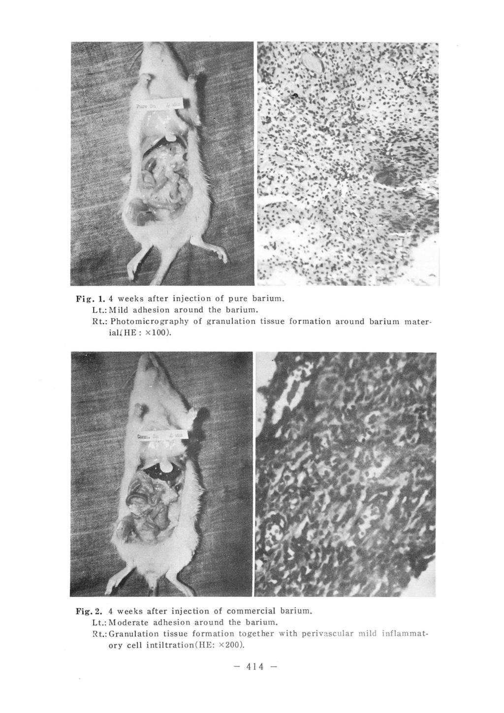 Fig. 1. 4 weeks after injection of pure barium. L t.: Mild adhesion around the barium. R t.: Photomicro graphy of granulation tissue formation around barium mater. ial[he: xloo). Fig.2.