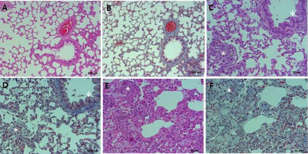 326 김종규ㆍ강민구ㆍ김수진ㆍ송세욱 Table 2. Histopathological finding of male rats(12-week intratracheal exposure group) Organs Liver Kidney Lung Summary of histopathological findings Sex : male Group(mg/0.