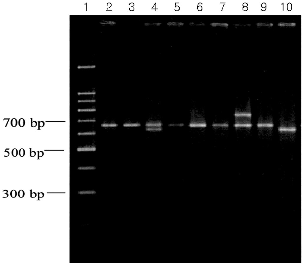 Interleukin-6 Gene Polymorphisms in Behcet s Disease 127 Fig. 3. Chromatograms produced DHPLC analysis of wild type and mutant type in IL-6prom. v BB, 77 (86.5%); BC, 12 (13.5%) ù kû.