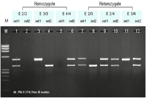 Fig. 1. Electrophoresis of apoe Genotypes Table 3. The Number of Cases and Ratio on apoe Genotype ApoεType Total(N=140) Ratio(%) ε2/ε2 0 0 ε3/ε3 90 64.3 ε4/ε4 5 3.6 ε2/ε3 9 6.4 ε2/ε4 5 3.