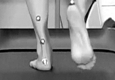 HY Kim. The Effect of Arch Pad on Ankle Kinematics during Running 등의성능을고려한신발의선택은발아치의지지구조와거골하관절의과도한회내운동을조절하기위한좋은방법 5) 이될수있다.