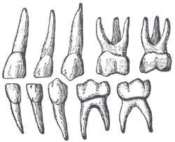 유치의종류 ( 총 5 종 20 개 ) 1악편측에 5개씩 1) 유절치 (deciduous incisor) 2종 8개 1 유중절치 (deciduous central incisor) 2 유측절치 (deciduous lateral