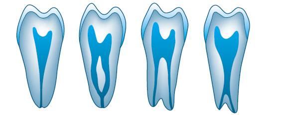 치근관의분류