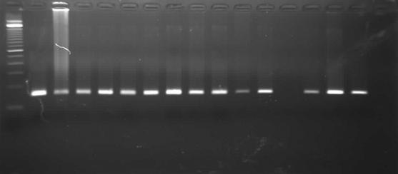 김도현외 15 인. UBT 양성인성인에서 Polyethylene Glycol 투여후 H. pylori 의발견 29 Fig. 1. Detection of H. pylori DNA in the rectal fluid and terminal ileal fluid by PCR.