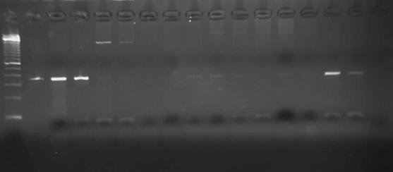 Summary of PCR and Culture Results from Rectal Fluid and Terminal Ileal Fluid of 20 Subjects Infected with Helicobacter pylori caga flaa 16S rrna urec Culture caga flaa 16S rrna urec Culture 1 2 3 4