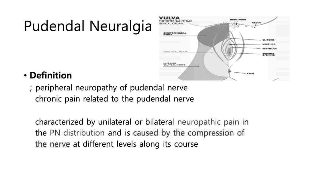 이대형 Pudendal Neuralgia Pudendal Neuralgia 이대형