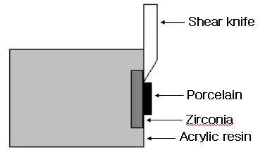 3) 레진포매 제작된시편을직경 30 mm 및높이 20 mm 의원기둥형태가되도록아크릴릭 레진으로포매하여전단결합강도측정용지그에고정될수있도록하였다. 나. 전단결합강도측정 하중이지르코니아블럭과도재사이의접착면과동일한방향으로전달되도록전단결합강도측정용지그에고정 (Figure 3) 한뒤, 만능시험기 (Instron 3366, Instron Corp.