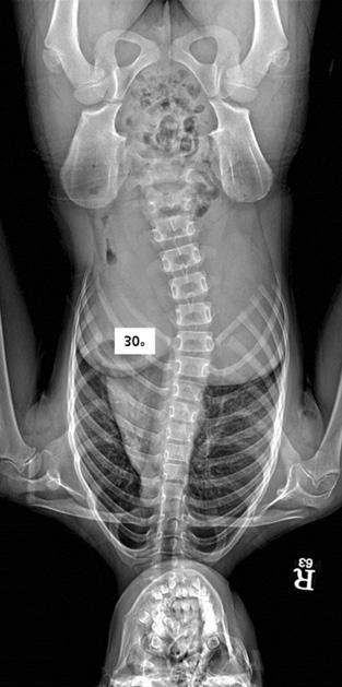 Therefore, early onset scoliosis is often defined as scoliosis that manifests before the age of 5 years, as compared to late onset scoliosis which manifests after the age of 5 years. 0.5 는것으로알려져있다.
