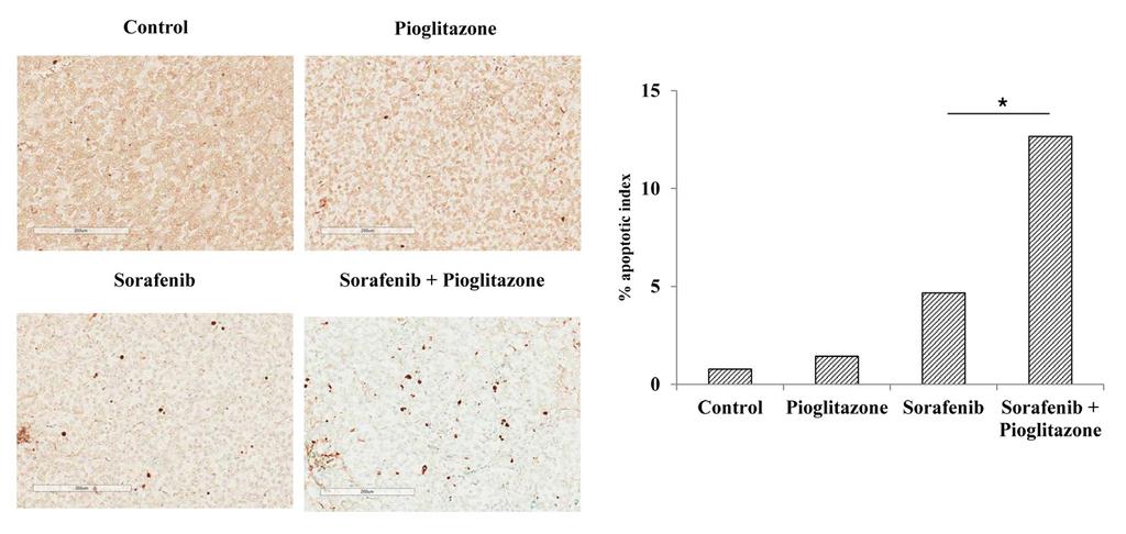 간세포암에서 sorafenib 과 pioglitazone 병합요법의상승적항암효과 13 Figure 7. In vivo demonstration of the anti-tumor efficacy of sorafenib and pioglitazone (PTEN activator).