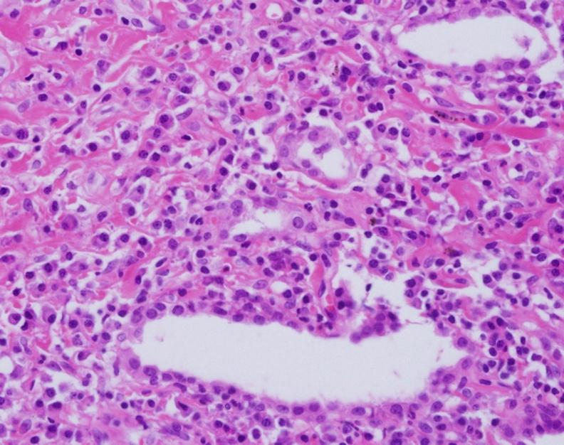 immunostaining). Patient 2.