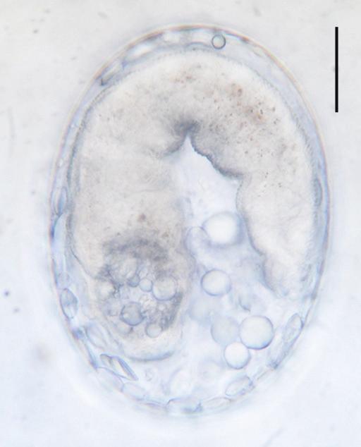 Chai et al.: Zoonotic trematode metacercariae from Yangon, Myanmar 635 A B C D E1 E2 F G Fig. 1.