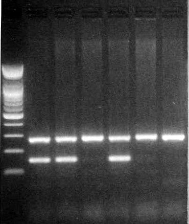 242 조선영 이광길 박수연외 1 인 a b c d P 1 2 3 4 N A P 1 2 3 4 N Fig. 1. Results of HLA-B27 typing. (A) Absolute TM HLA-B27 PCR kit (Biosewoom), (B) In-house PCR with B27 280 primer.