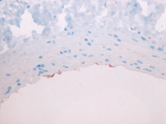 9%, everolimus군 6.5±3.5%, p<0.01) rdu 에염색되는세포들중대부분은 α-smooth muscle actin 에도염색되었다 (Fig.