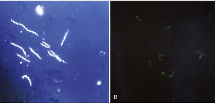 04 2018 Spring A B Figure 3. In vitro diagnostic modalities for venereal syphilis detection. A: Dark field microscopy technique ( 400) reveals the presence of motile spirochetes.