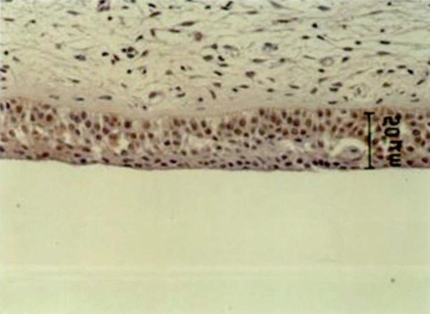 위의 membrane 하비갑개의 전단부에서 편평 상피 부위와 중간부에서 점 을 deprobing 후 actin 항체(Santa Cruz Biotechnology 액섬모 상피조직 부위를 선택하였다. 각각에 대해 15-LO Inc.