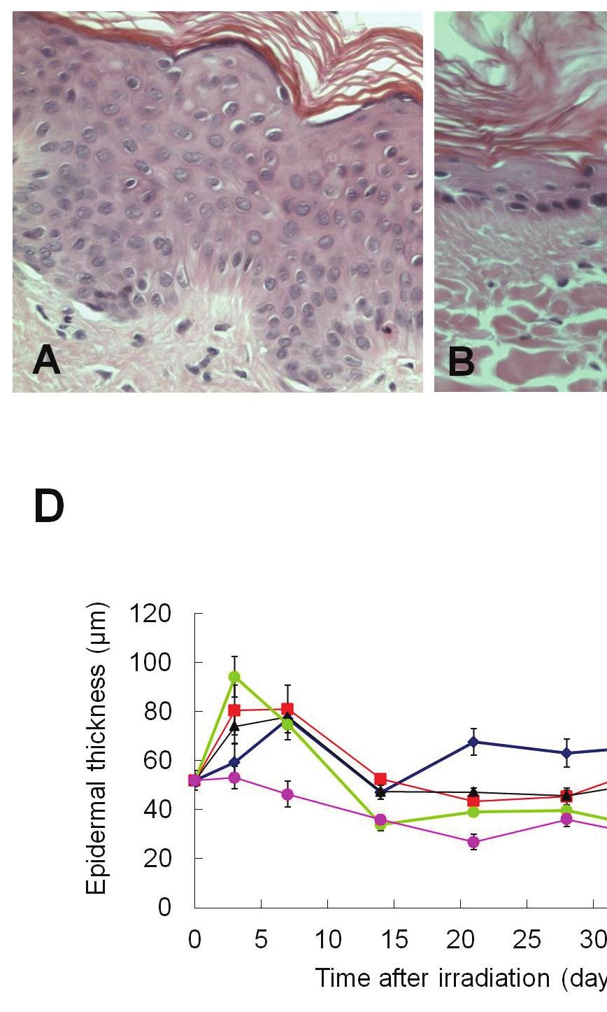 Fig. 3. Histological changes in mini-pig skin following gamma irradiation (20 70 Gy).
