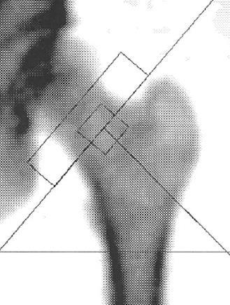 content Dual X-ray Absorptiometry (DXA) Ultrasonic