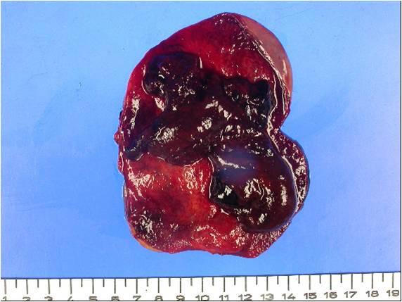 The gall bladder walls were thickened and hemorrhagic, and blood clots were observed within the gall bladder lumen.