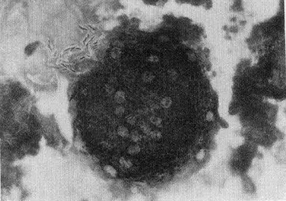 .., 3mm 두께의적충막 Fig. 2. The small granules were found between hooklet and honeycomb like vacuoles.