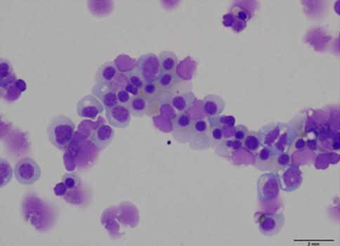StemPro 배지에서는 적 혈구로의 분화가 천천히 진행되었지만 배양 21일 까지 세포의 형태는 Stemline 배지에 비해 잘 유지 되면서