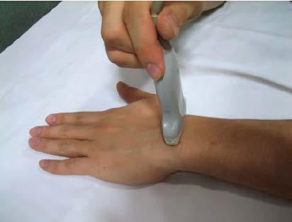 손목의손등쪽검사 6 개의구획 (compartment) Lister s tubercle