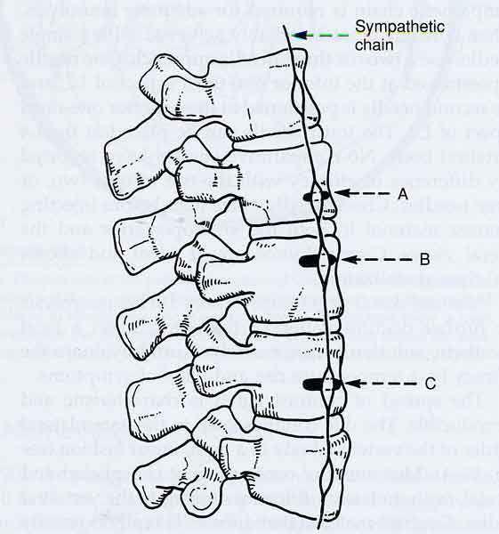 Lumbar