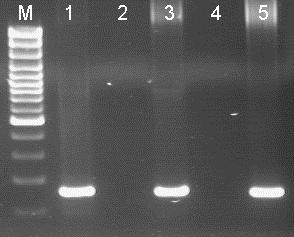 151bp M : 100bp DNA Ladder marker 1 : Positive sample 2 :