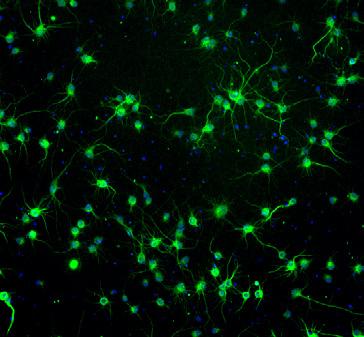 Plus Neuronal Culture System 이출시되었습니다.