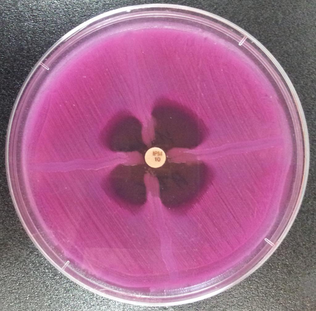 Korean J Clin Lab Sci. Vol. 50, No. 4, December 2018 Figure 1. Image of hodge test with positive reaction for A. baummanii producing carbapenemase. 435 Figure 3.