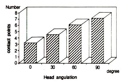 Variation of numbers of contact point on the six-anterior teeth region due to each head angulation Ⅲ. 연구성적 1.