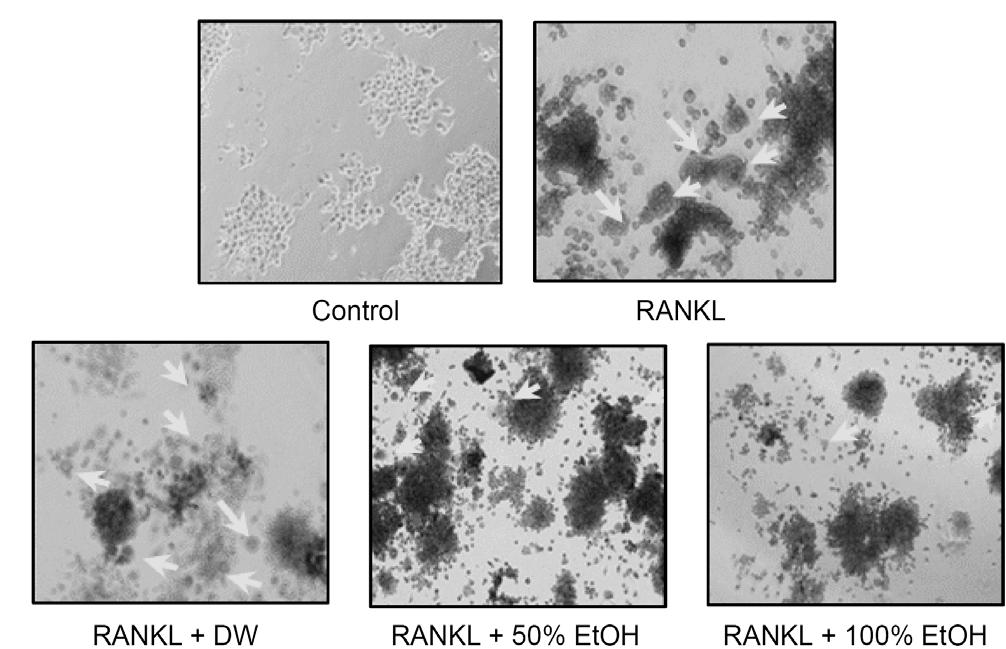RANKL 에의해유도되는파골세포분화에대한시금치추출물의영향 535 Cell viability (%).