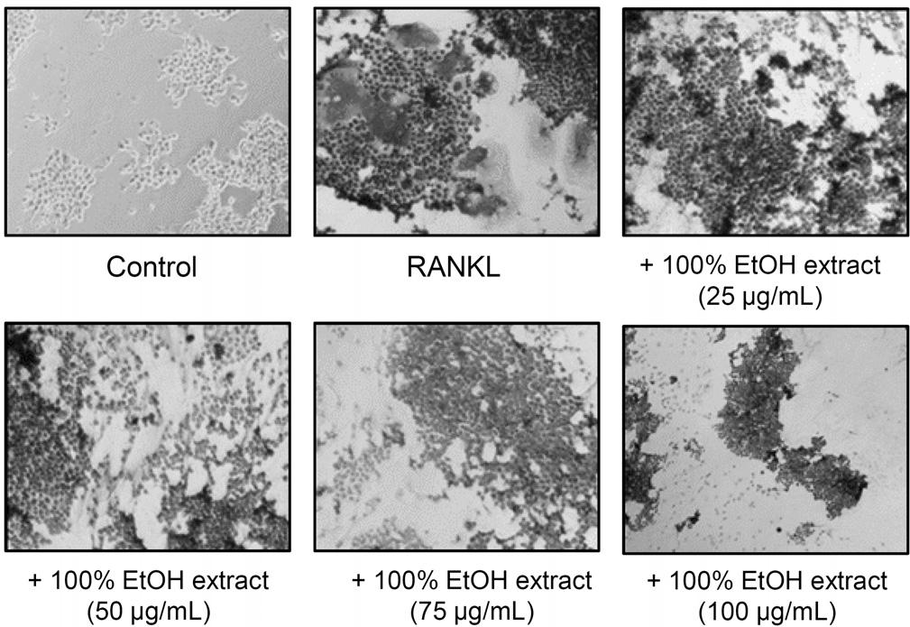 536 김동규 김미혜 강민정 신정혜 A B C TRAP (+) cells ( 3 nuclear). RANKL 25 5 75 TRAP activity (%). RANKL 5 1 25 5 RANKL+spinach % EtOH extracts (μg/ml) RANKL+spinach % EtOH extracts (μg/ml) Fig. 3. Spinach extract inhibited RANKL-induced osteoclast differentiation of RAW264.