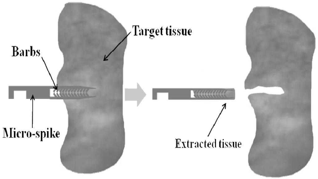 마이크로 스파이크로 채취한 조직의 진단을 위한 미세 조직회수도구 Fig. 1. 21 Tissue extracting mechanism with micro-spike. 수도구 파라핀 블록으로 만드는 것이 가능해 진다.