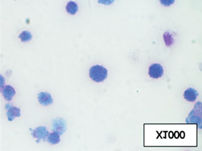 3). Human promyelocytic leukaemia cell line인 HL-60은 MPO 및 SBB 염색에서 양성이고[7], human acute monocytic leukaemia cell line인 THP-은 PAS 및 ANAE 염색에서 양성이었다[8].
