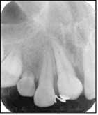 Initial intraoral view Fig. 13.