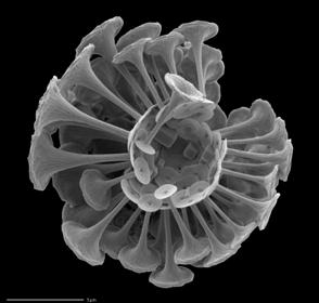 [ 그림 17-19 원석조류 Discosphaera tubifera] 작은세포는트럼펫형의원석비에의해훨씬큰체적으로둘러쌓여있음. ( 출처 : http://ina.tmsoc.org) 늘 coccoliths [ 그림 17-20 섬모를가진원생생물 ]. Paramecium 을먹는 Didinium (SEM).