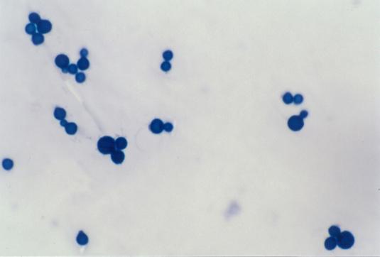 임성욱등 : Inverse Pityriasis Versicolor 3 예 Fig. 3. Spherical circular cells with buds formed on narrow base (Case 1, Parker ink-koh stain, 1000).