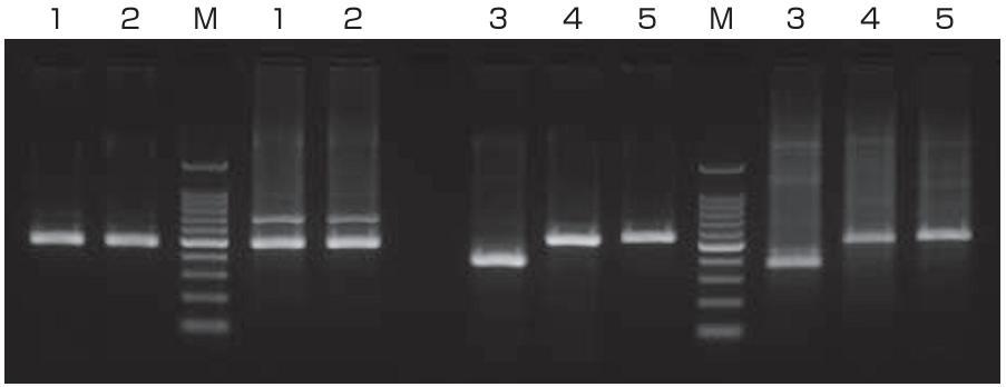 NEW TaKaRa PCR Thermal Cycler Fast 비특이적증폭의감소 장치 A 장치 B 장치 A 장치 B TaKaRa PCR Thermal Cycler Fast 의 High-Power Peltier 에의한 fast ramp 기능으로, ramp rate 가큰폭으로단축 되기때문에 Primer 의 mis-annealing