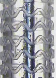 (B) The scaffold features in-phase sinusoidal hoops linked by three straight connectors. (C) A scaffold post-dilated to a diameter of 4.75 mm without strut fracture.
