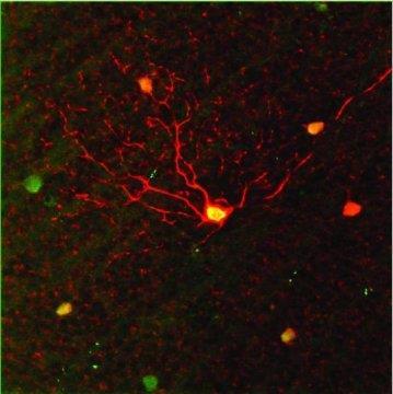 01. 국내외뇌연구학술동향 출처 : Neuron 2. Retinal Ganglion Cells 의 Gap Junction 이빛을받아들이기위한차등적조절을함 * 원문보기 : https://www.cell.