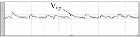 5나 Table 3의이동평균되지않은원본전압파형을보면, 싸이리스터출력주파수특성을가지는미세한리플이전압의기울기라는수학적파라메터로 V ap 를판단함에있어서노이즈로작용할것이다.