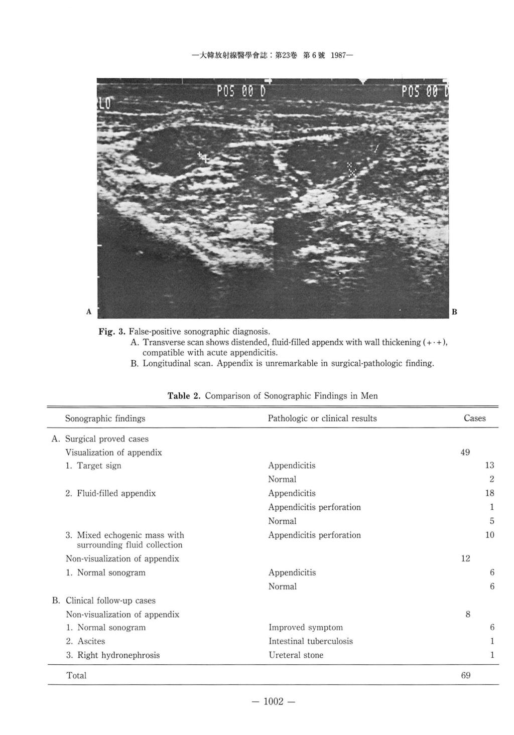 - 大협放射線뽑學會찮 第 23 卷第 6 號 1987- Fig. 3. False-positive sonographic diagnosis.. Transverse scan shows distended, fluid-filled appendx with wall thickening (+. + ), compatible with acute appendicitis.