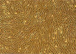 Primary CEFs Plaque purification 작업완료 그림 13. primary Chicken Embryo Fibroblast cell 을이용한 plaque purification 재조합된바이러스의 SPF chicken embryo egg 에서의 growth 측정.