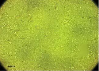 그림 20. Photograph of MDCK and VERO cell line adapted to Provero-1 medium.