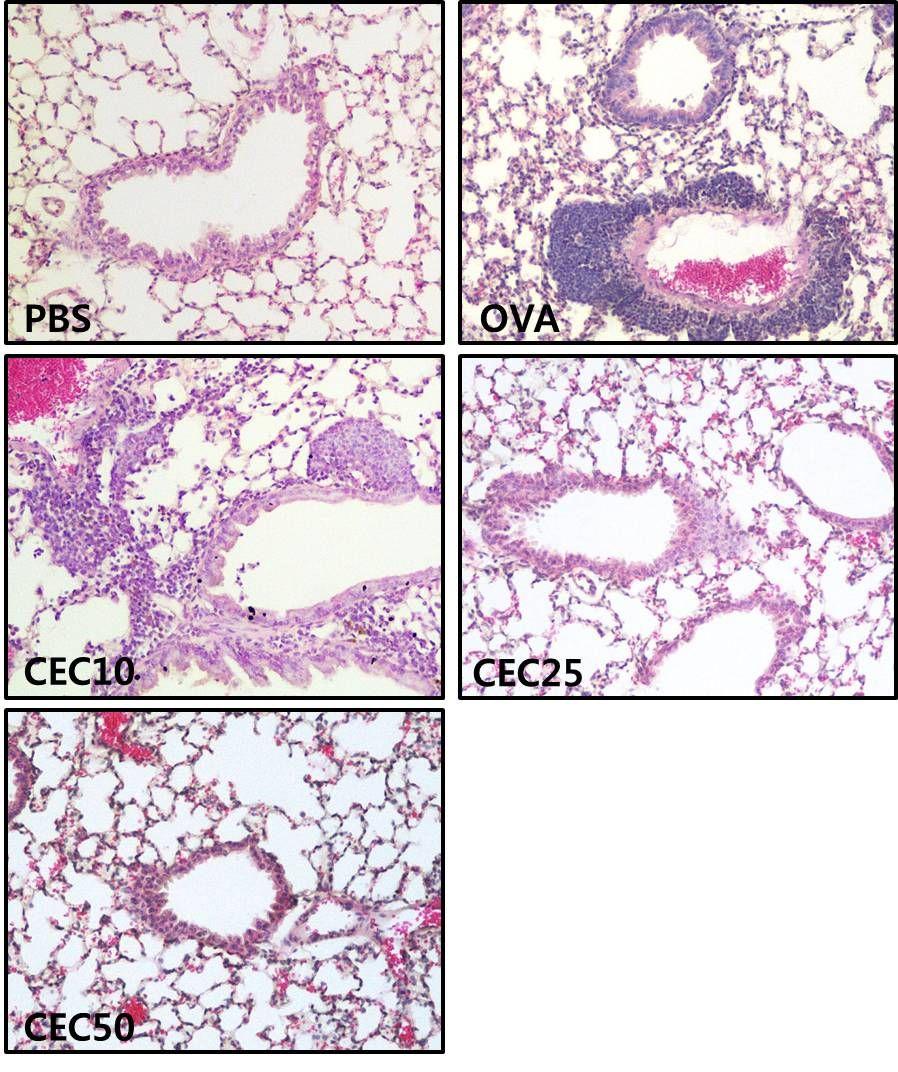 Fig. 3. Histopathological observation of the lungs of mice sensitized with PBS, OVA, or OVA+CEC.