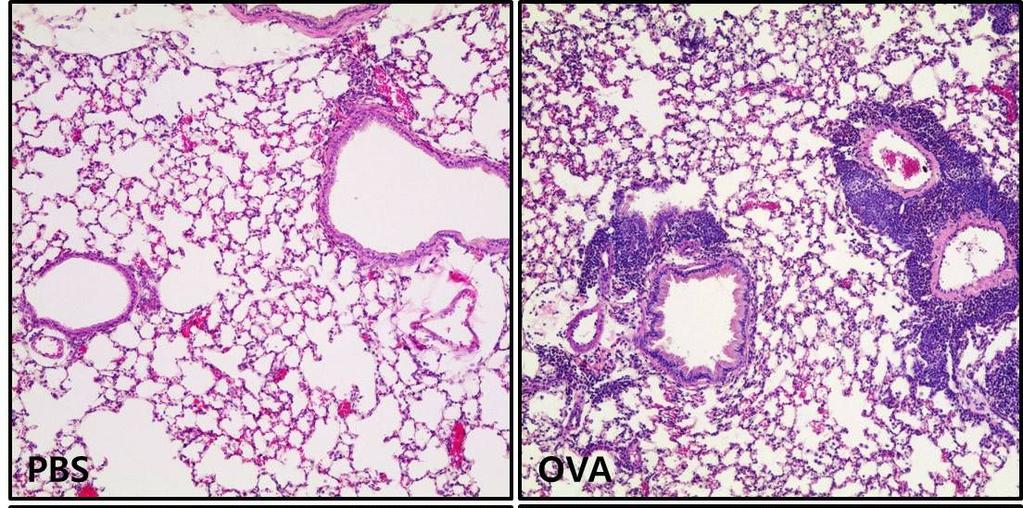 Fig. 7. Histopathological observation of the lungs of mice with OVAinduced asthma.