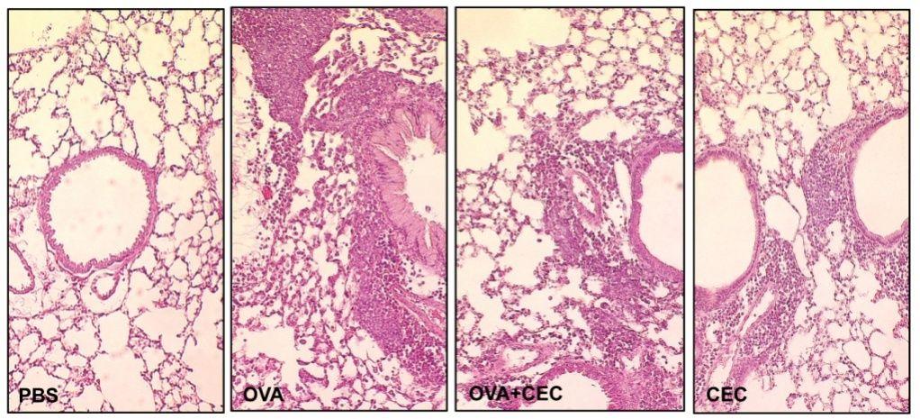 Fig. 15. Histopathological observation of the lungs of mice with established asthma.