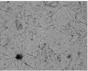 겐타마이신에의해유발된세포자멸사의특성 120 Control Gentamicin (10 μm) % Viability 80 60 40 20 A 0 0 1 10 1,000 2,000 Gentamicin (μm) 120 Cisplatin (200 μm) Gentamicin ( μm) Fig. 1. Light microscopic findings.