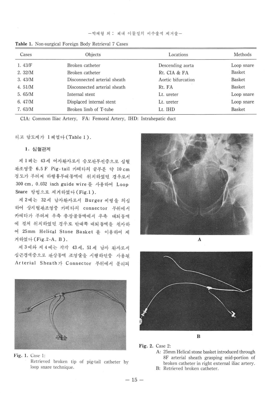 Table 1. Non-surgical Foreign Body Retrieval 7 Cases 박재형외체내이물질의 <;1 수숭석제거술 - Cases Objects Locations Methods 1. 43/F Broken catheter Descending aorta 2. 321M Broken catheter Rt. CIA & FA 3.
